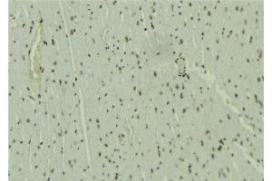 ABIN6277652 at 1/100 staining Mouse muscle tissue by IHC-P. (WHSC1L1 antibody  (N-Term))