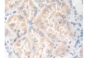 Immunohistochemistry (IHC) image for anti-Kallikrein 11 (KLK11) (AA 39-282) antibody (ABIN7432349)