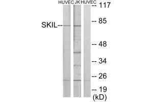 Western blot analysis of extracts from HUVEC cells and Jurkat cells, using SKIL antibody. (SKIL antibody  (C-Term))