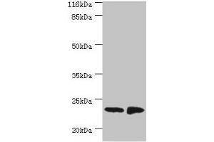 Western blot All lanes: C7orf50 antibody at 2 μg/mL Lane 1: A549 whole cell lysate Lane 2: MCF-7 whole cell lysate Secondary Goat polyclonal to rabbit IgG at 1/10000 dilution Predicted band size: 23 kDa Observed band size: 23 kDa (SAMD9 antibody  (AA 1-194))