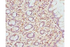 Immunohistochemistry of paraffin-embedded human small intestine tissue using ABIN7151501 at dilution of 1:100 (ETFDH antibody  (AA 318-617))