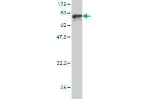 Western Blot detection against Immunogen (80. (ALT antibody  (AA 1-496))