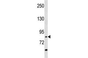 RIPK4 antibody western blot analysis in A549 lysate (RIPK4 antibody  (AA 802-832))