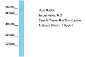 Image no. 1 for anti-Transcription Factor 3 (E2A Immunoglobulin Enhancer Binding Factors E12/E47) (TCF3) (AA 551-600) antibody (ABIN6750234) (TCF3 antibody  (AA 551-600))