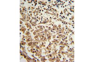 Formalin-fixed and paraffin-embedded human lymph with TERT Antibody (S1125), which was peroxidase-conjugated to the secondary antibody, followed by DAB staining. (TERT antibody  (AA 1104-1132))