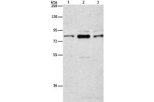 Western Blot analysis of Human brain malignant glioma tissue, A172 and 293T cell using ARHGEF7 Polyclonal Antibody at dilution of 1:800