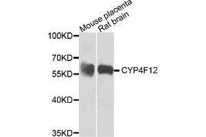 Western blot analysis of extracts of various cell lines, using CYP4F12 antibody (ABIN5974476) at 1/1000 dilution. (CYP4F12 antibody)