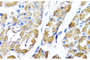 Immunohistochemistry of paraffin-embedded Human stomach using HYAL1 Polyclonal Antibody at dilution of 1:100 (40x lens). (HYAL1 antibody)