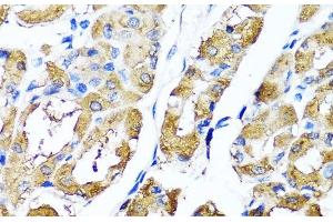 Immunohistochemistry of paraffin-embedded Human stomach using HYAL1 Polyclonal Antibody at dilution of 1:100 (40x lens). (HYAL1 antibody)