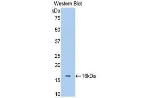 Western blot analysis of the recombinant protein. (FETUB antibody  (AA 28-141))