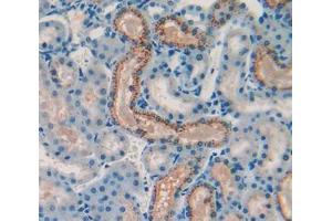 Immunohistochemistry (IHC) image for anti-Hypoxia Inducible Factor 1, alpha Subunit (Basic Helix-Loop-Helix Transcription Factor) (HIF1A) (AA 641-810) antibody (ABIN1859154)