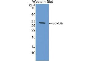 Western Blotting (WB) image for anti-Interleukin 17 Receptor D (IL17RD) (AA 356-603) antibody (ABIN1859364) (IL17RD antibody  (AA 356-603))