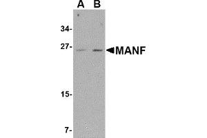 Western Blotting (WB) image for anti-Mesencephalic Astrocyte-Derived Neurotrophic Factor (MANF) (C-Term) antibody (ABIN1030505) (MANF antibody  (C-Term))
