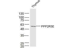 Mouse thymus lysates probed with PPP2R5E Polyclonal Antibody, Unconjugated  at 1:300 dilution and 4˚C overnight incubation. (PPP2R5E antibody  (AA 121-220))