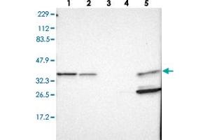 Western blot analysis of Lane 1: RT-4, Lane 2: U-251 MG, Lane 3: Human Plasma, Lane 4: Liver, Lane 5: Tonsil with ARPC1B polyclonal antibody . (ARPC1B antibody)