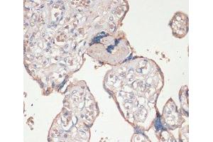 Immunohistochemistry of paraffin-embedded Human placenta using ASC / TMS1 Polyclonal Antibody at dilution of 1:100 (40x lens). (PYCARD antibody)