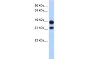 Western Blotting (WB) image for anti-Chitinase, Acidic (CHIA) antibody (ABIN2463911) (CHIA antibody)
