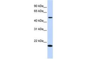 Image no. 1 for anti-Zinc Finger Protein 493 (ZNF493) (N-Term) antibody (ABIN6741148)