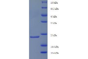 N-Acylsphingosine Amidohydrolase (Non-Lysosomal Ceramidase) 2B (ASAH2B) (AA 1-165), (full length) protein (His tag)