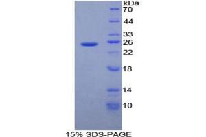 SDS-PAGE analysis of Human ADH1 Protein. (ADH1 Protein)