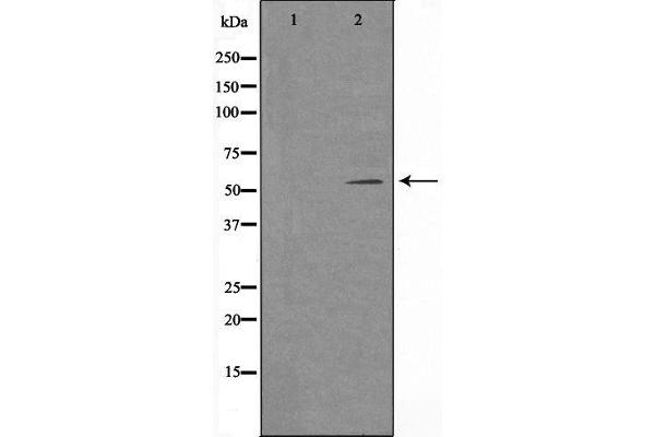 TSEN54 antibody  (Internal Region)