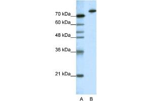 WB Suggested Anti-KLHL3 Antibody Titration:  1. (KLHL3 antibody  (N-Term))