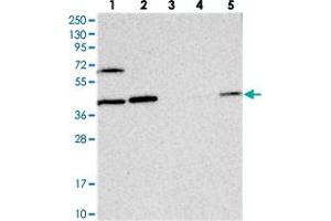 Western blot analysis of Lane 1: RT-4, Lane 2: U-251 MG, Lane 3: Human Plasma, Lane 4: Liver, Lane 5: Tonsil with COPS4 polyclonal antibody  at 1:250-1:500 dilution. (COPS4 antibody)