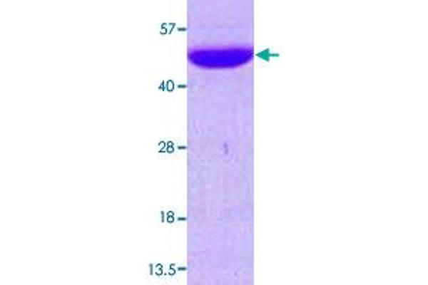 NDRG1 Protein (AA 1-394) (His tag)