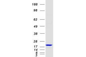 Validation with Western Blot