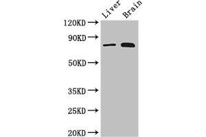 Western Blot Positive WB detected in: Mouse liver tissue, Mouse brain tissue All lanes: TBK1 antibody at 3 μg/mL Secondary Goat polyclonal to rabbit IgG at 1/50000 dilution Predicted band size: 84 kDa Observed band size: 84 kDa (TBK1 antibody  (AA 364-585))