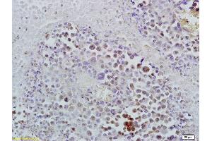 Formalin-fixed and paraffin embedded rat brain tissue labeled with Anti-ID1 Polyclonal Antibody, Unconjugated (ABIN700330) at 1:200 followed by conjugation to the secondary antibody and DAB staining (ID1 antibody  (AA 51-155))