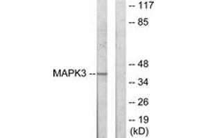 Western blot analysis of extracts from COLO205 cells, using MAPK3 Antibody. (ERK1 antibody  (AA 301-350))