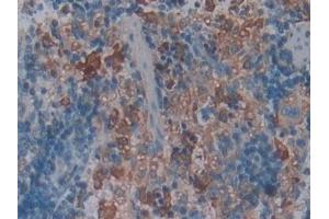 Detection of FCN1 in Rat Spleen Tissue using Polyclonal Antibody to Ficolin 1 (FCN1) (FCN1 antibody  (AA 25-279))