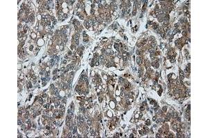 Image no. 4 for anti-Bruton Agammaglobulinemia tyrosine Kinase (BTK) antibody (ABIN1496976) (BTK antibody)