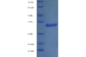 SDS-PAGE (SDS) image for Trimethylguanosine Synthase 1 (TGS1) (AA 713-853), (partial) protein (His-SUMO Tag) (ABIN4976626)