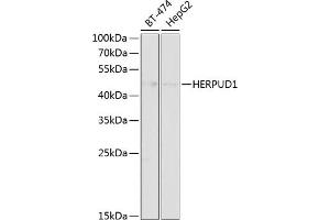 Western blot analysis of extracts of various cell lines, using HERPUD1 antibody (ABIN6130838, ABIN6141721, ABIN6141723 and ABIN6218339) at 1:1000 dilution. (HERPUD1 antibody  (AA 1-240))