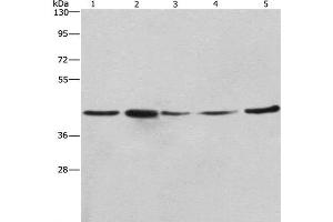 Western Blot analysis of A549, NIH/3T3 and 293T cell,Human hepatocellular carcinoma tissue and hela cell using RPSA Polyclonal Antibody at dilution of 1:425 (RPSA/Laminin Receptor antibody)