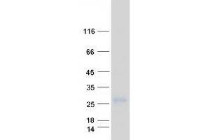 Validation with Western Blot (EMP1 Protein (Myc-DYKDDDDK Tag))