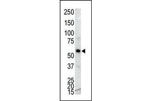 Western blot analysis of anti-CK 1G Pab (ABIN391376 and ABIN2841387) in NCI- cell lysate. (CAMK1G antibody  (C-Term))