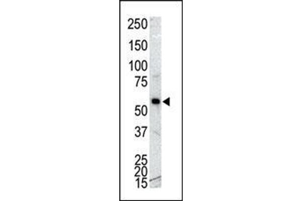 CAMK1G antibody  (C-Term)