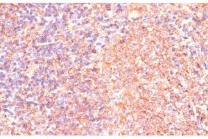 Immunohistochemistry of paraffin-embedded Rat spleen using IL4R Polyclonal Antibody at dilution of 1:100 (40x lens). (IL4 Receptor antibody)