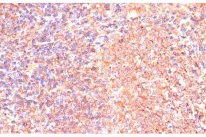 Immunohistochemistry of paraffin-embedded Rat spleen using IL4R Polyclonal Antibody at dilution of 1:100 (40x lens). (IL4 Receptor antibody)