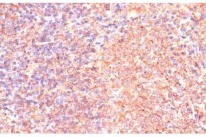 Immunohistochemistry of paraffin-embedded Rat spleen using IL4R Polyclonal Antibody at dilution of 1:100 (40x lens).