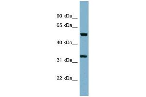 WB Suggested Anti-TMEM158 Antibody Titration:  0. (TMEM158 antibody  (Middle Region))