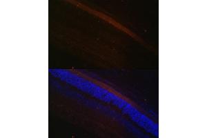 Immunofluorescence analysis of rat retina using GRK1 Polyclonal Antibody (ABIN6134352, ABIN6141414 and ABIN7101798) at dilution of 1:100 (40x lens).