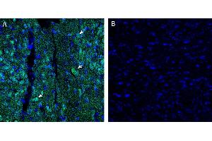 anti-EPH Receptor A5 (EPHA5) (AA 357-369), (Extracellular), (N-Term) antibody