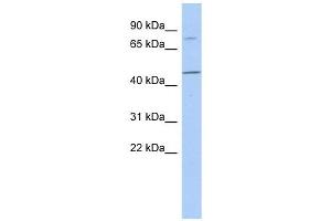 FBXO39 antibody used at 1 ug/ml to detect target protein.