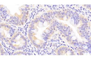 Detection of MT2 in Human Small intestine Tissue using Polyclonal Antibody to Metallothionein 2 (MT2) (MT2 antibody  (AA 2-61))