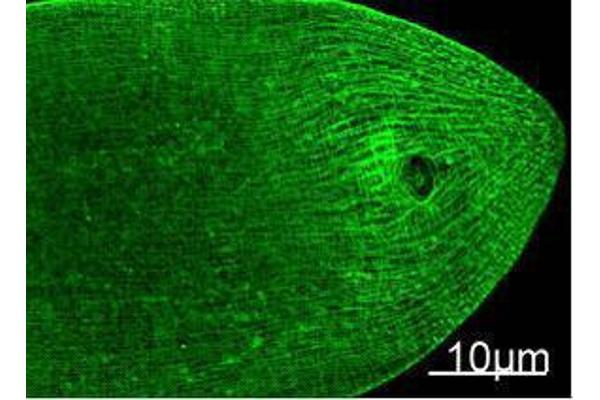 Myosin Heavy Chain antibody
