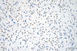 anti-Polypyrimidine Tract Binding Protein 1 (PTBP1) antibody